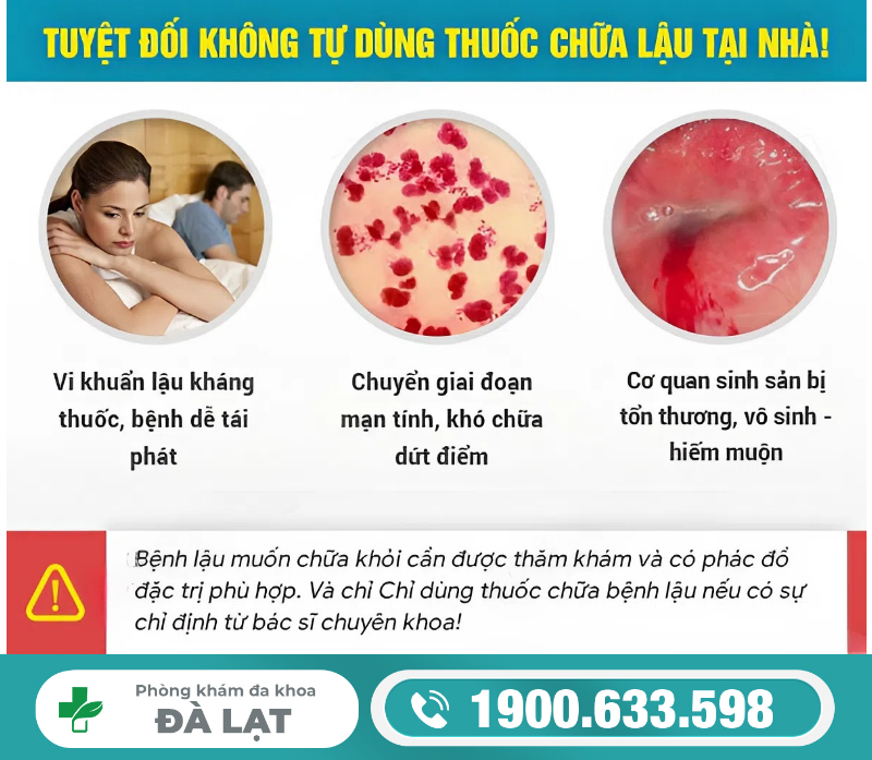 Hình ảnh minh họa